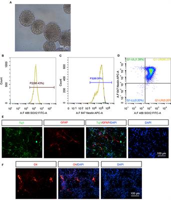 Intranasal Transplantation of Human Neural Stem Cells Ameliorates Alzheimer's Disease-Like Pathology in a Mouse Model